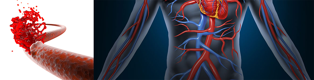 Vascular-Injury-in-Orthopedic-Trauma2